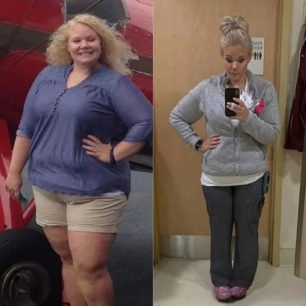TrimPatch™ | Lose up to 42lb in just 30 days!