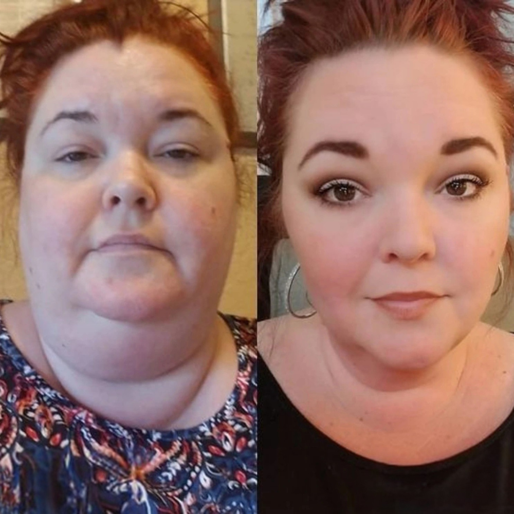 TrimPatch™ | Lose up to 42lb in just 30 days!